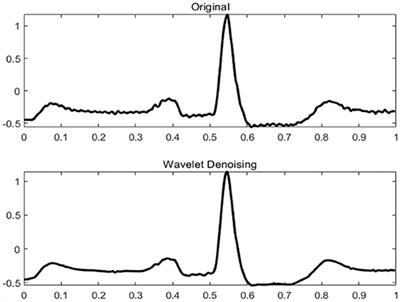 A Study on Arrhythmia via ECG Signal Classification Using the Convolutional Neural Network